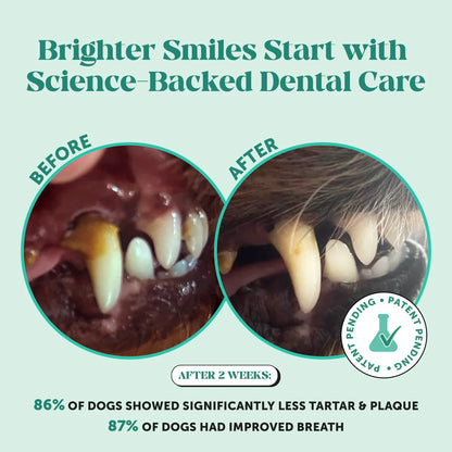 Clavya™ Plaque Plus Dental Powder